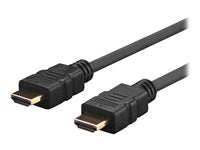 Eet HDMI-Kabel 5 m – Hochwertige Verbindung, Schwarz